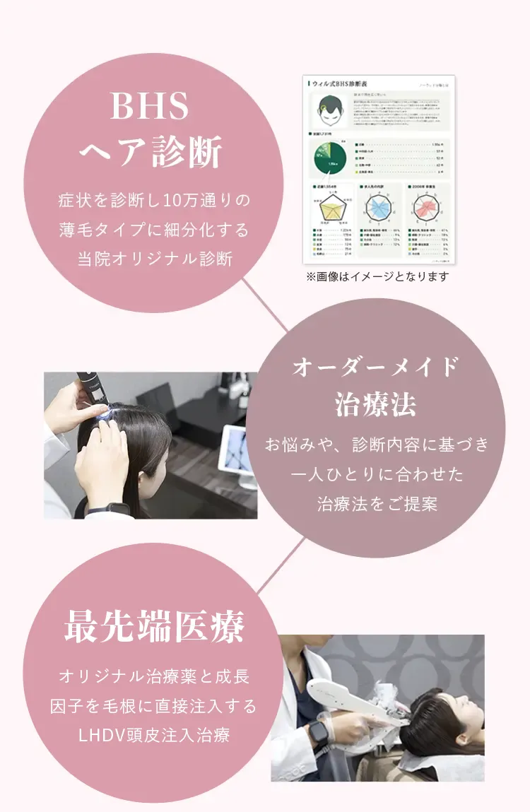 ・BHSヘア診断　症状を診断し10万通りの薄毛タイプに細分化する当院オリジナル診断　・オーダーメイド治療法　お悩みや、診断内容に基づき一人ひとりに合わせた治療法をご提案　・最先端医療　オリジナル治療薬と成長因子を毛根に直接注入する毛髪再生メソセラピー