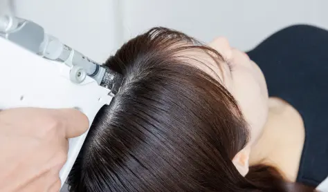 LHDV頭皮注入治療イメージ