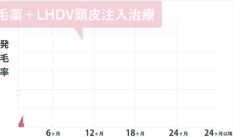 LHDV頭皮注入治療イメージ