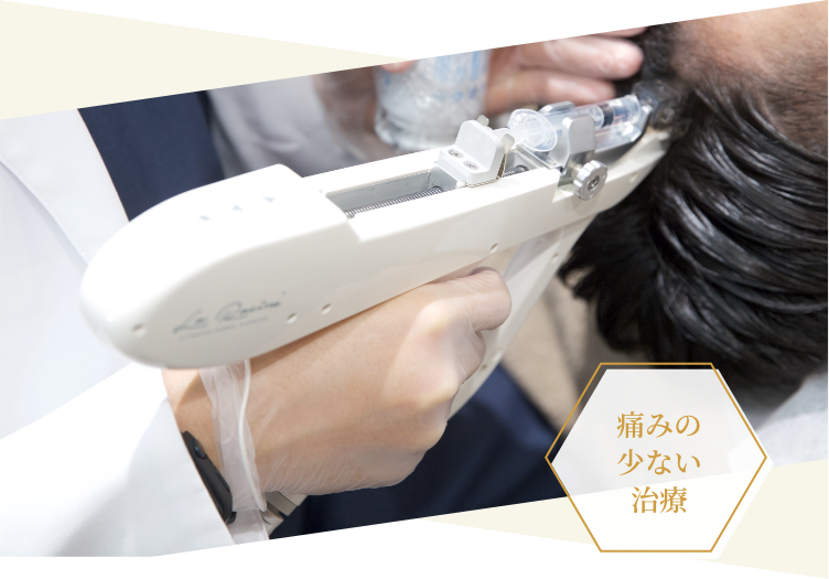 最新LHDV頭皮注入治療