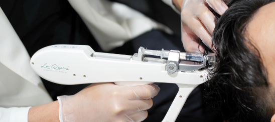 最新LHDV頭皮注入治療