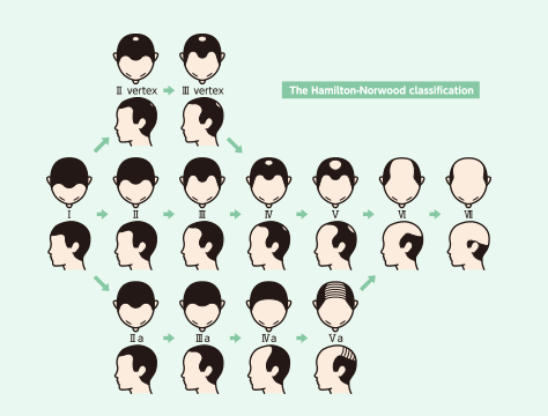 ハミルトンノーウッド分類