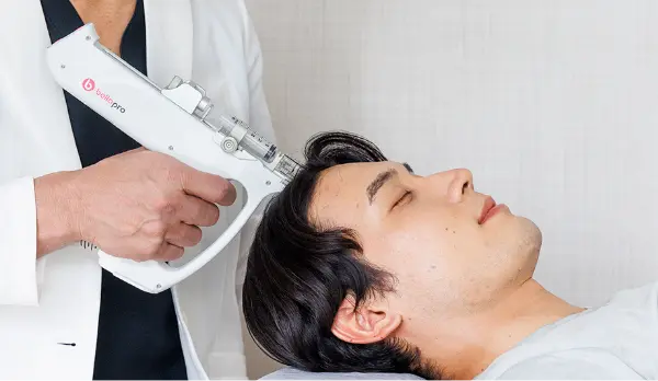 最新LHDV頭皮注入治療