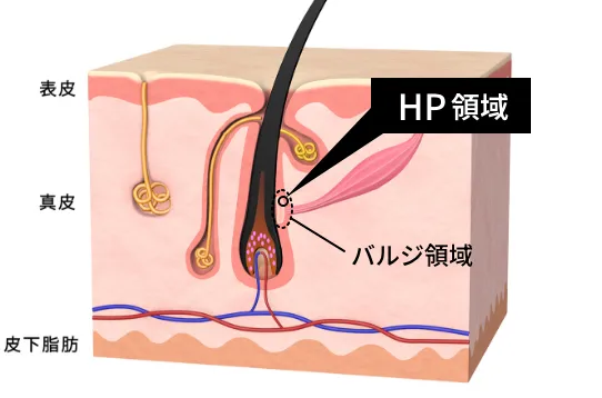 HP領域の図