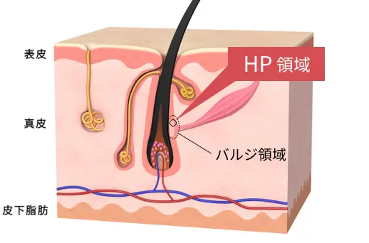 HP領域の図