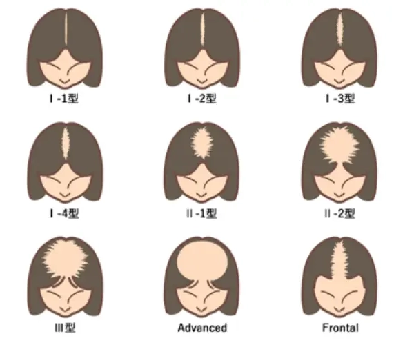 ルードヴィヒ分類図