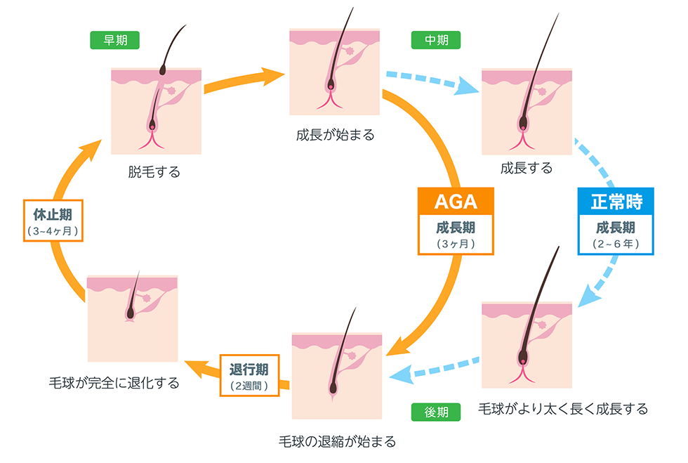 毛髪のサイクル