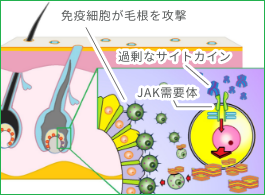 オルミエント治療薬を飲む男性