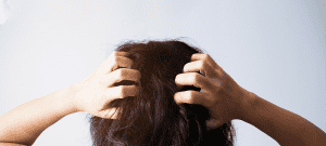 頭皮のかゆみの原因と対策