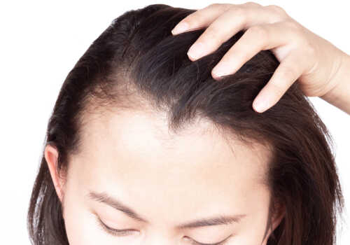 前髪の薄毛が気になる方へ 皮膚科医が解説 原因と対策 公式 ウィルagaクリニック