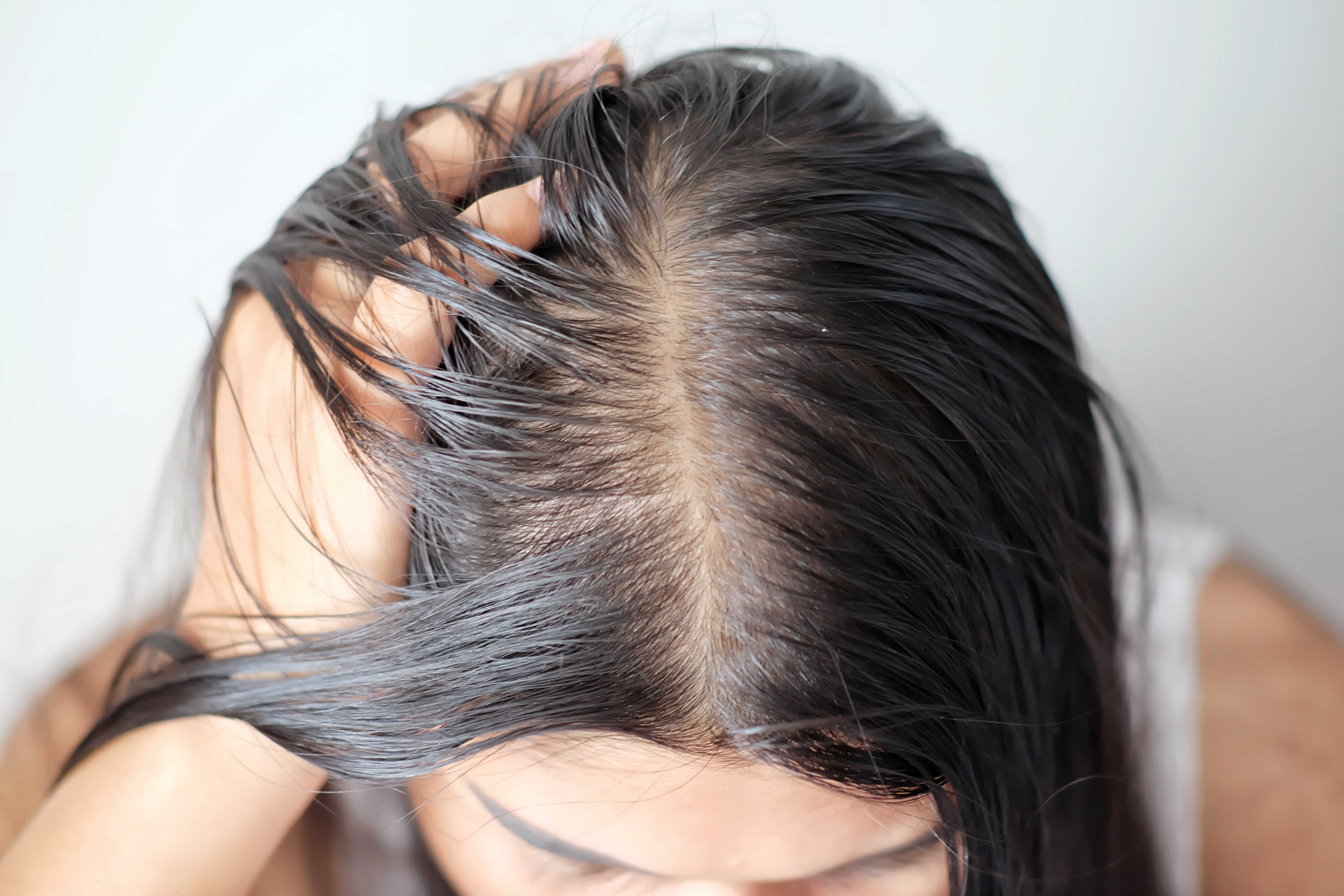 薄毛　改善　女性