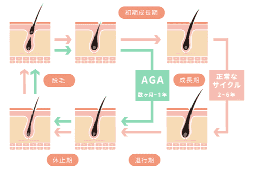 抜け毛の毛根から髪の毛の健康をチェックしよう 公式 ウィルagaクリニック