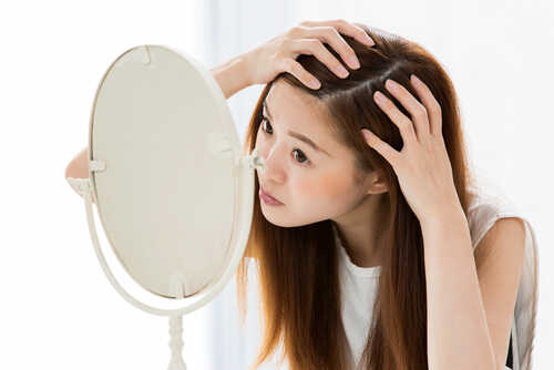 女性のつむじの薄毛とは 原因と対策を解説 Aga 抜け毛 女性薄毛治療の病院 ウィルagaクリニック