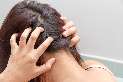 頭皮にもヘルペスはできる 湿疹 ブツブツ 炎症の原因と対処法 公式 ウィルagaクリニック