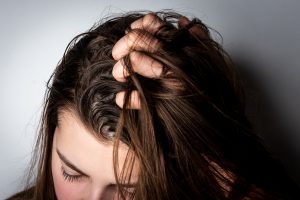 皮脂が多いと抜け毛が増える 皮脂と抜け毛の関係性 Aga 抜け毛 女性薄毛治療の病院 ウィルagaクリニック