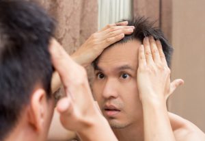 頭皮のニキビと円形脱毛症の関係性は 症状のチェックリストと対処法 Aga 抜け毛 女性薄毛治療の病院 ウィルagaクリニック