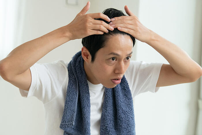 頭皮を気にする若い日本人男性