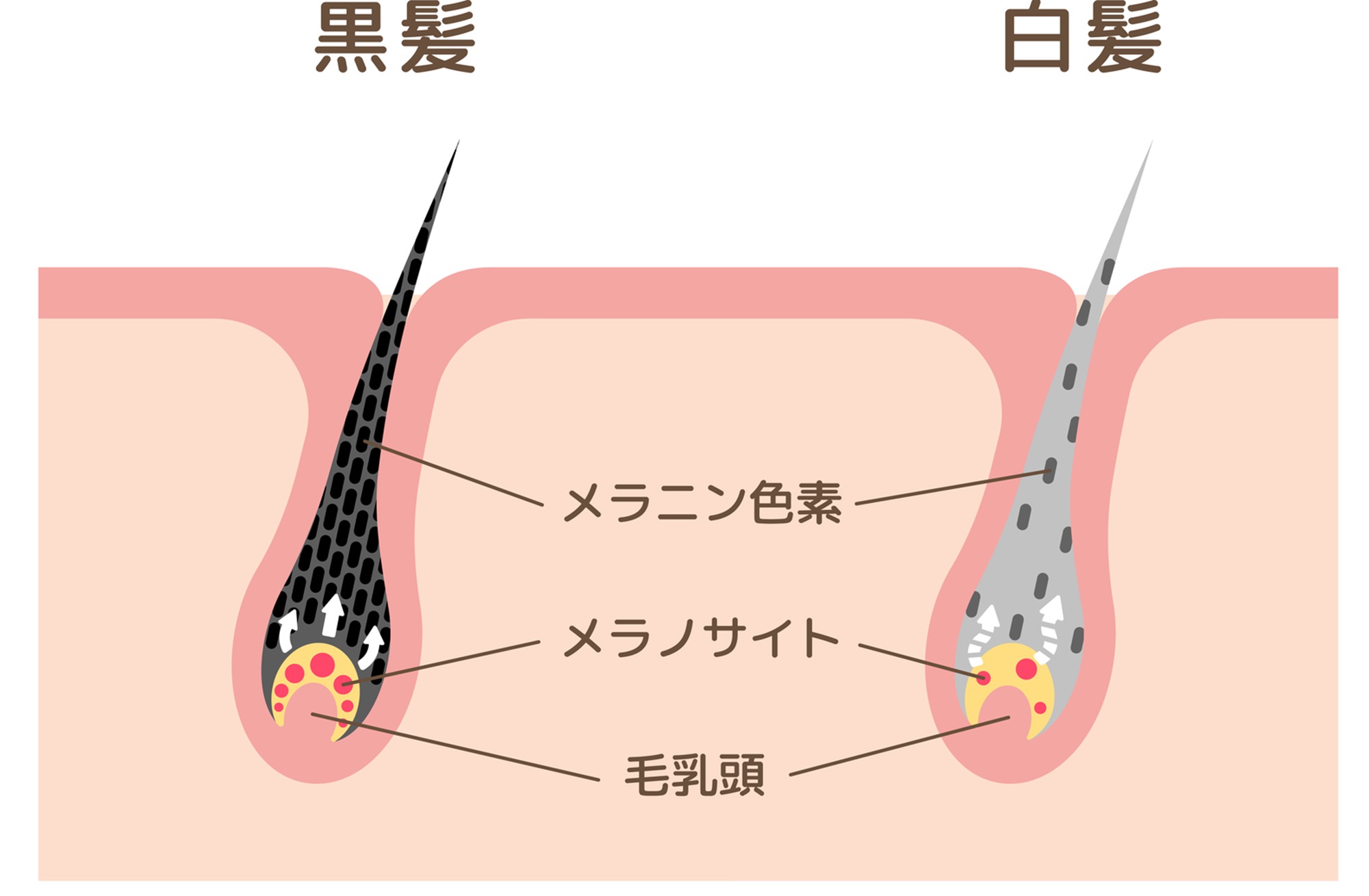 白髪について