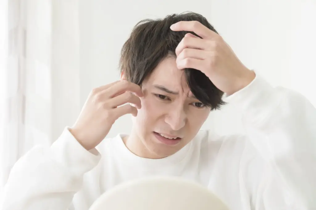 生え際を気にする男性